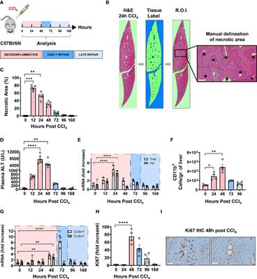 Distinct spatial distribution and roles of Kupffer cells and monocyte-derived macrophages in mouse acute liver injury